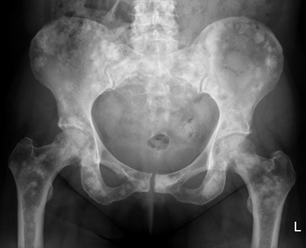 Bone & joint disease radiograph for self-assessment