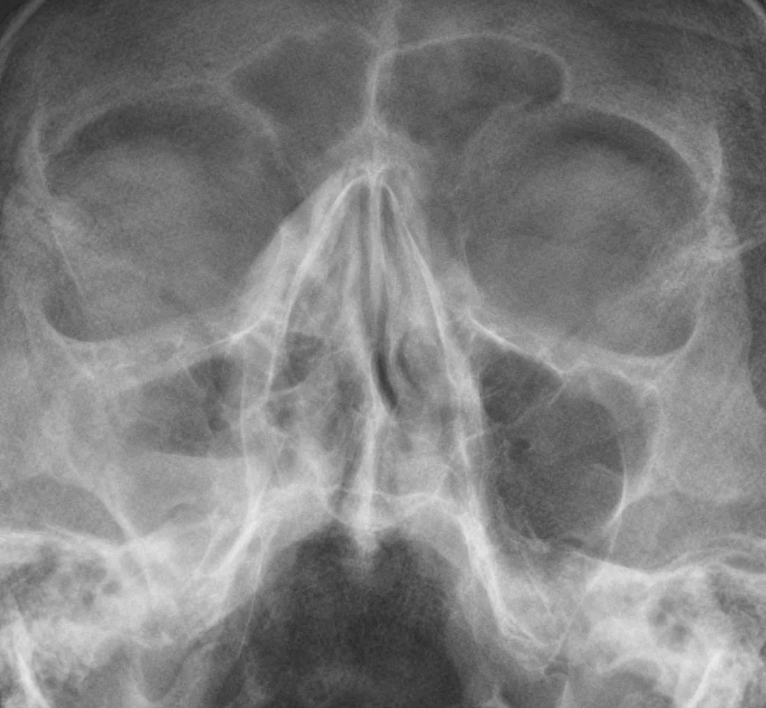 Skull & face radiograph for self-assessment