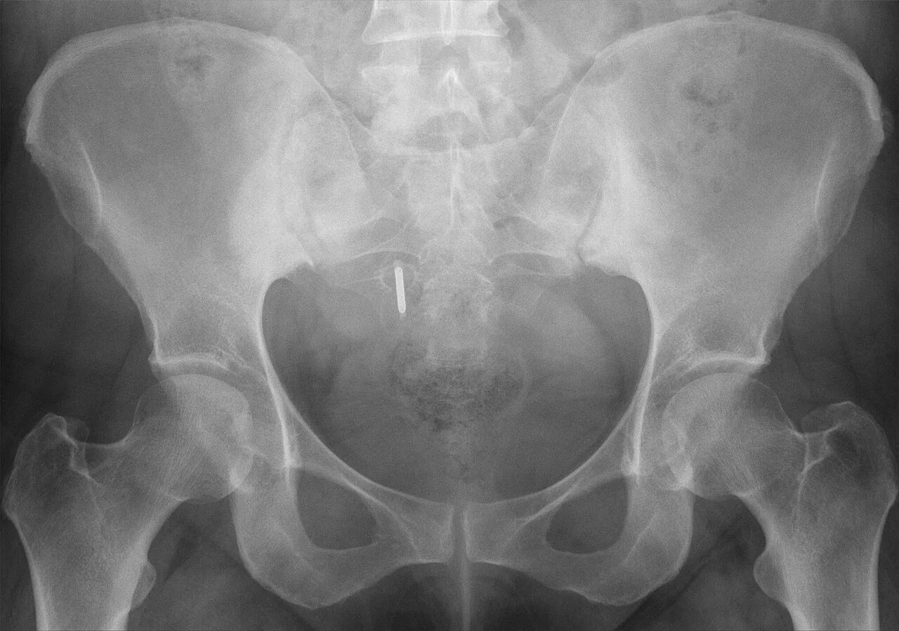 Abdomen radiograph for self-assessment
