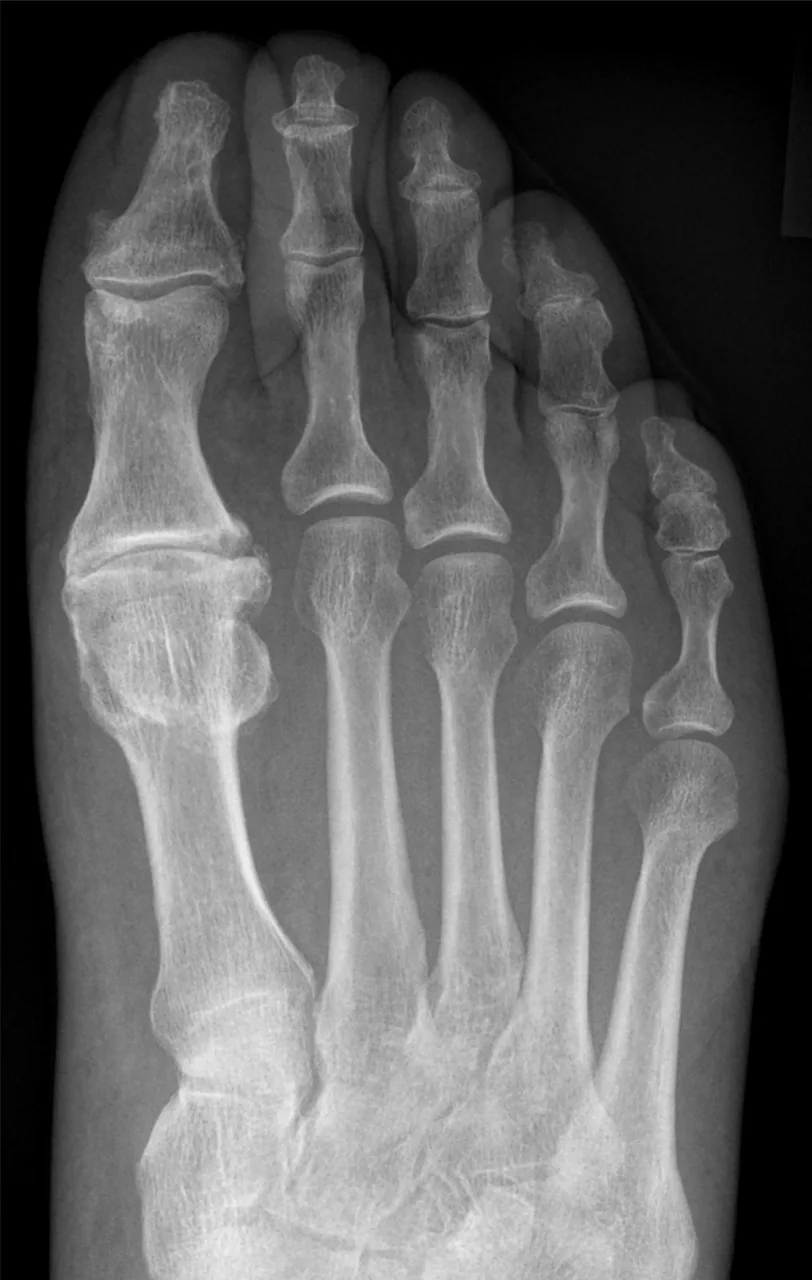 Bone & joint disease radiograph for self-assessment