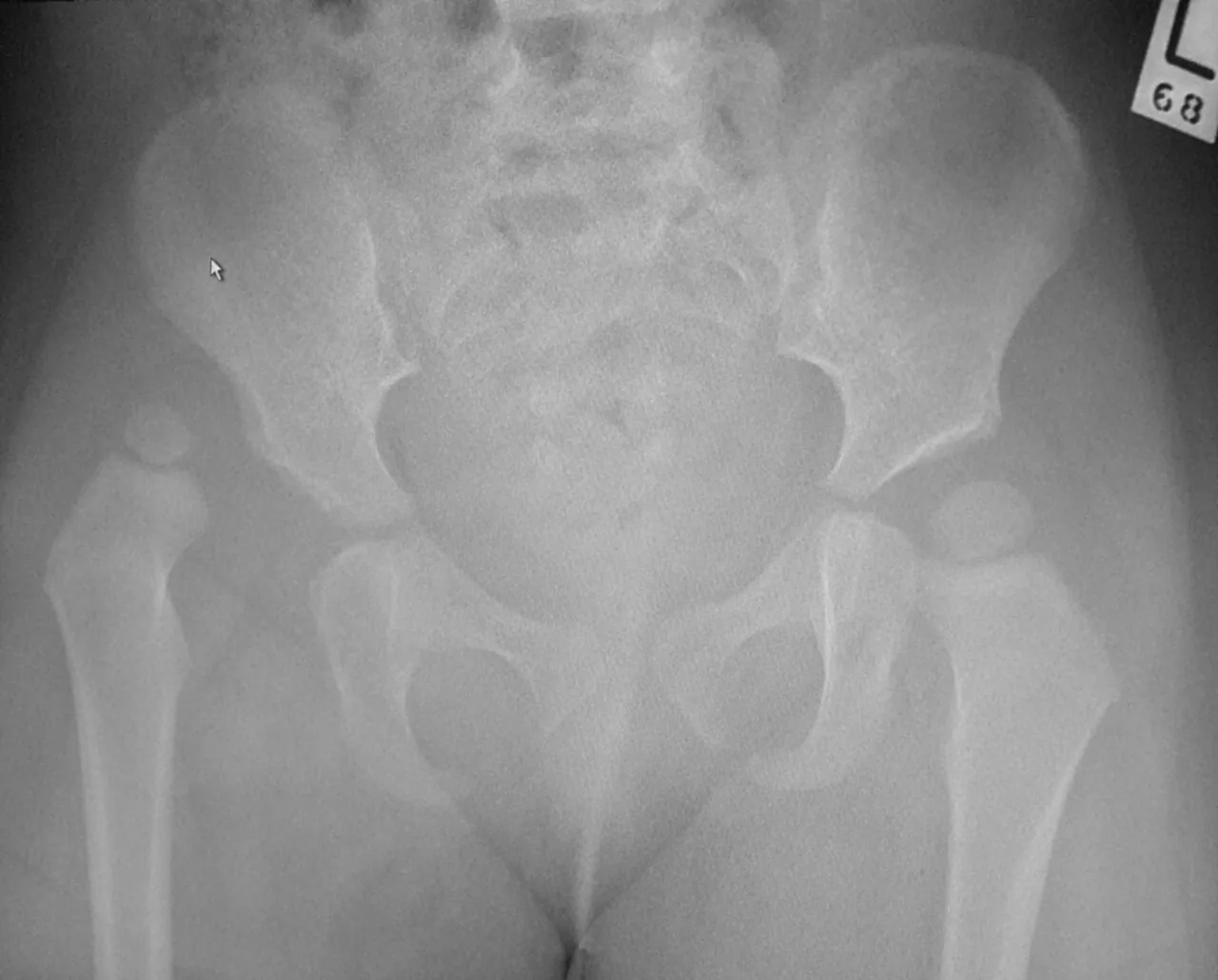 Lower limb radiograph for self-assessment