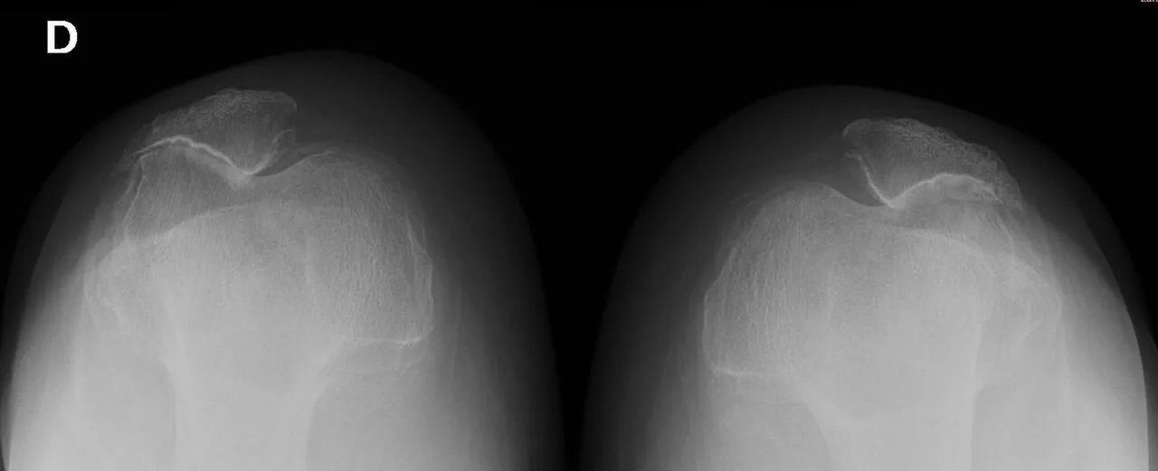 Bone & joint disease radiograph for self-assessment
