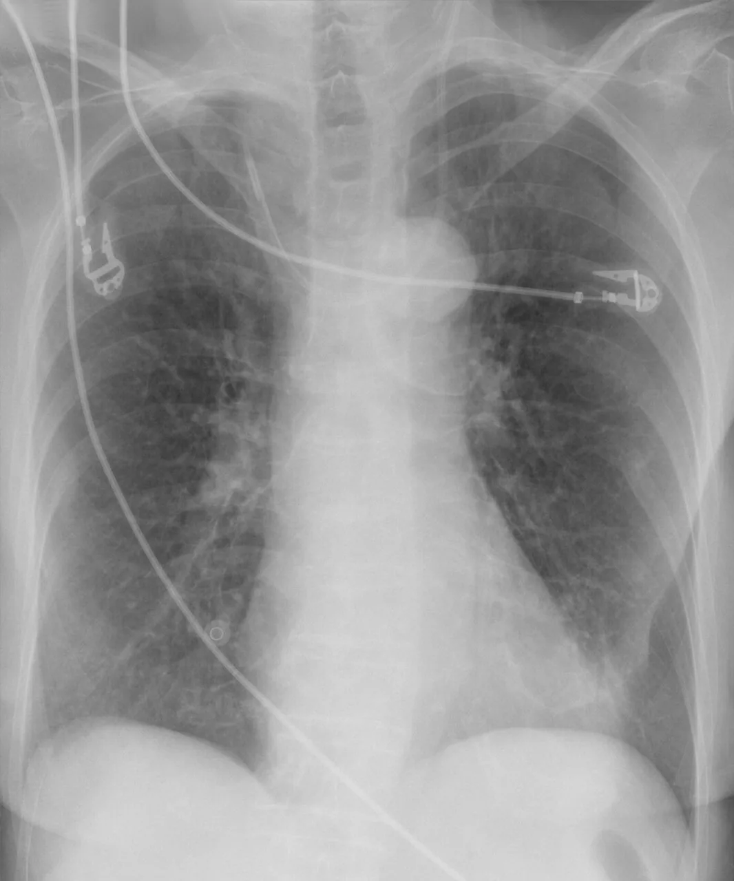 Lines & tubes radiograph for self-assessment