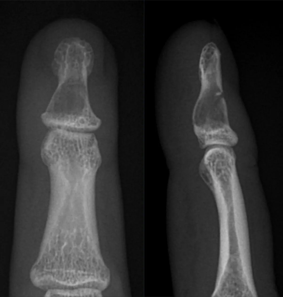 Bone & joint disease radiograph for self-assessment