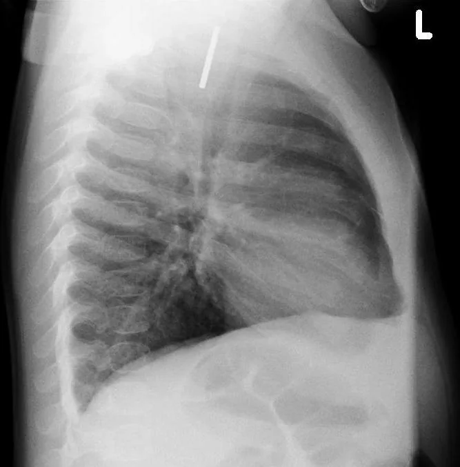Paediatric radiograph for self-assessment