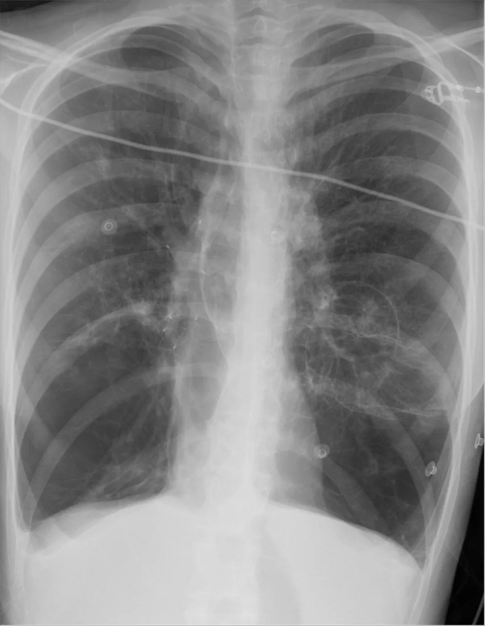 Chest radiograph for self-assessment