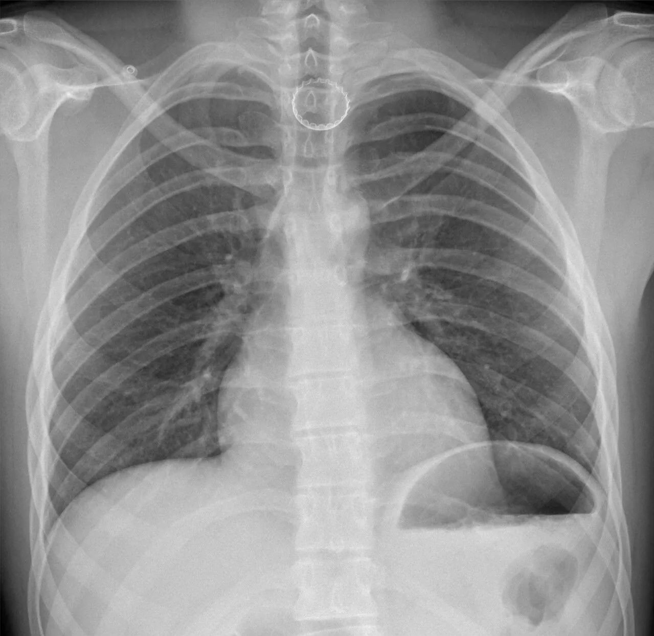 Paediatric radiograph for self-assessment
