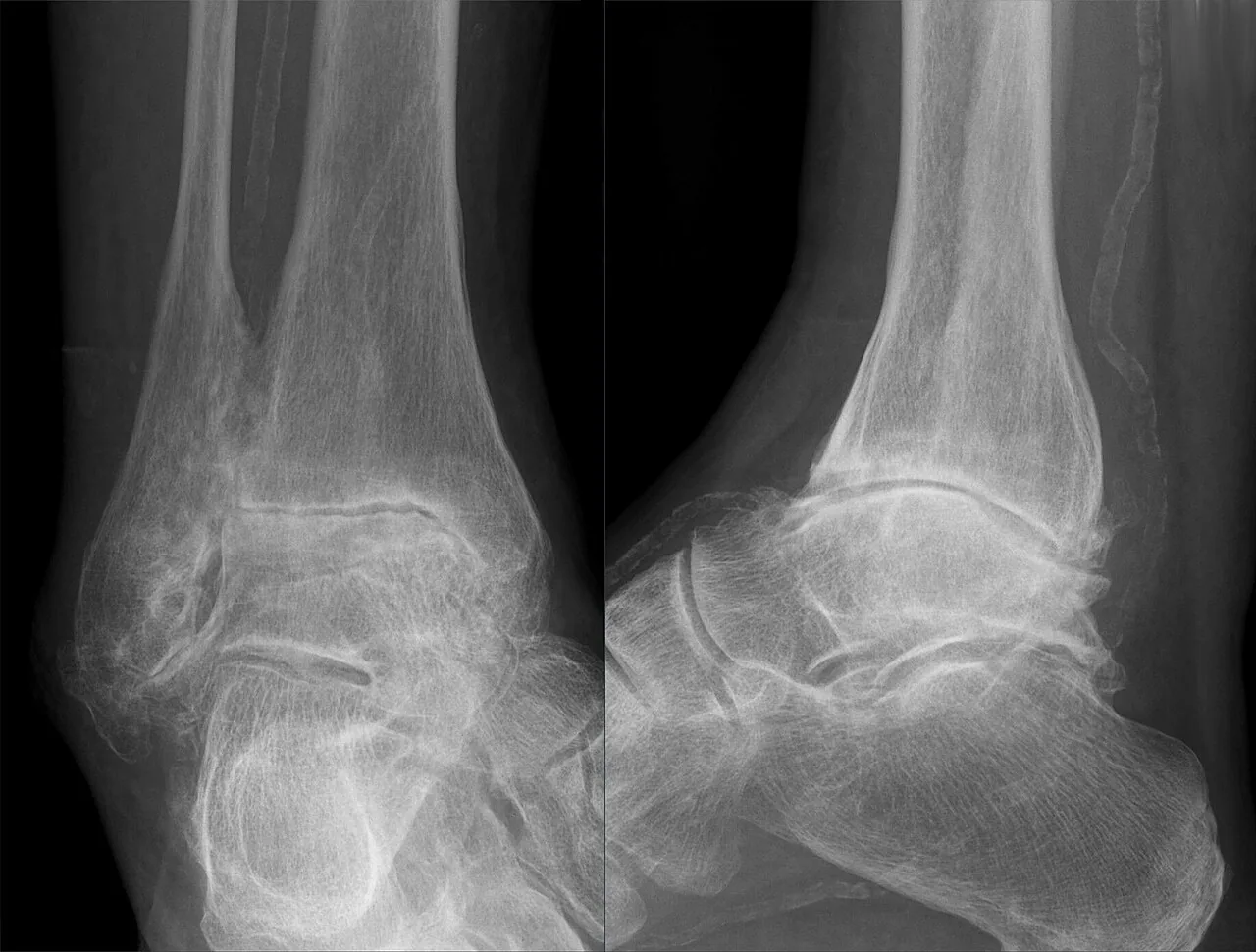Bone & joint disease radiograph for self-assessment