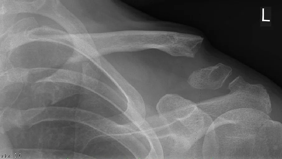 Upper limb radiograph for self-assessment