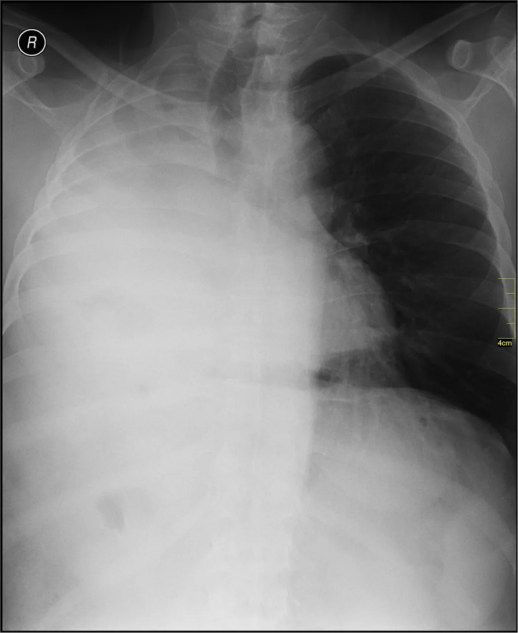 Chest radiograph for self-assessment