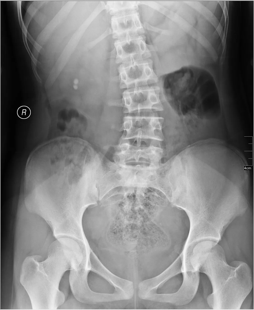 Abdomen radiograph for self-assessment