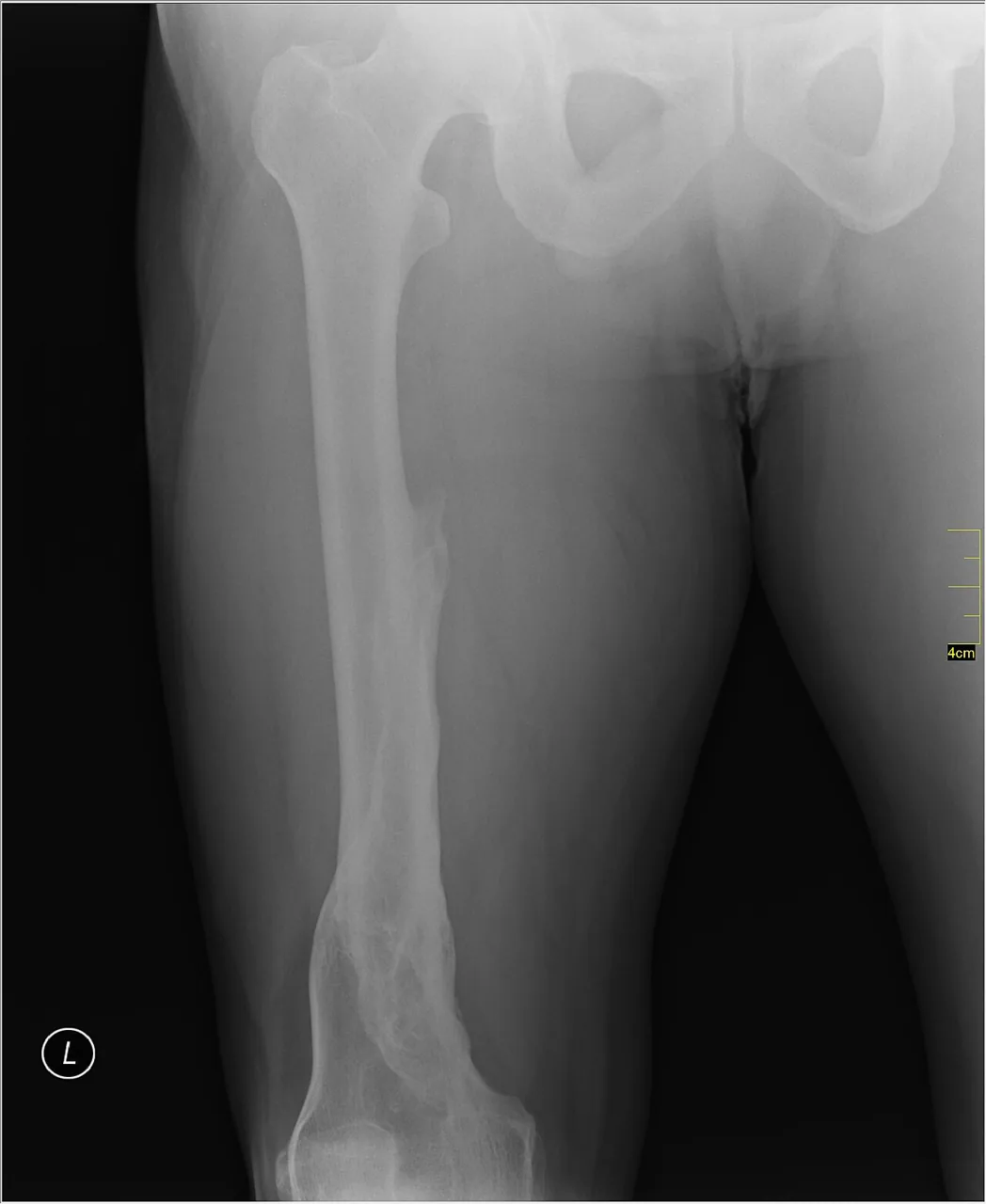 Lower limb radiograph for self-assessment