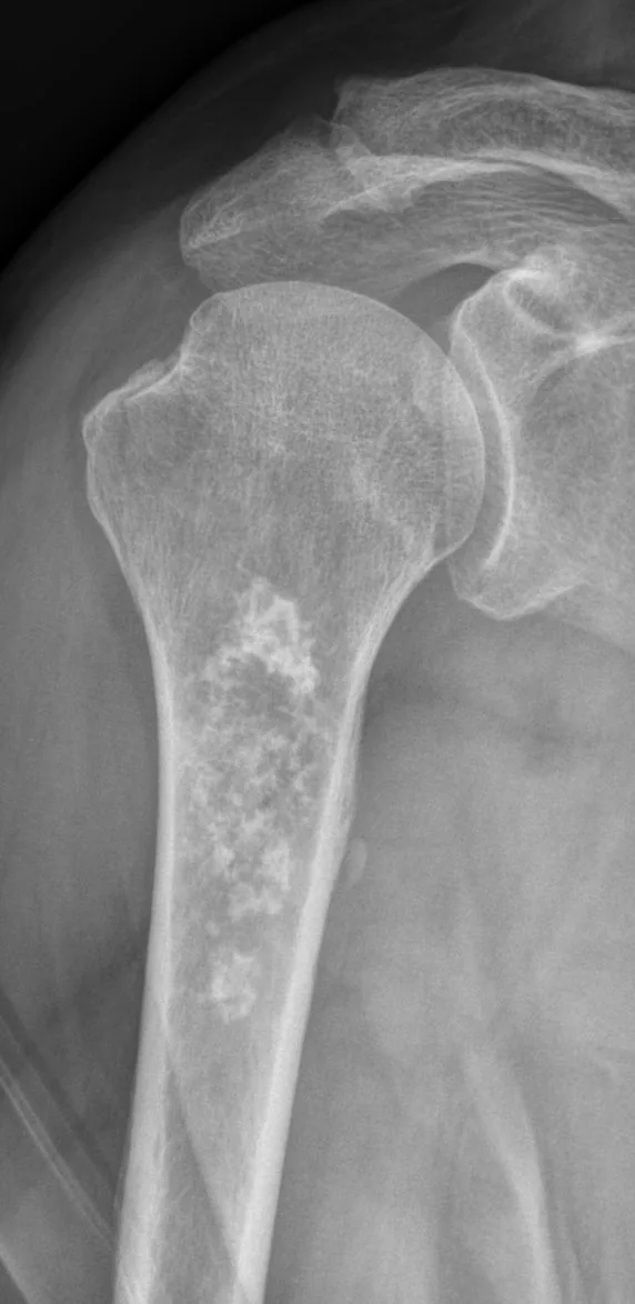 Bone & joint disease radiograph for self-assessment