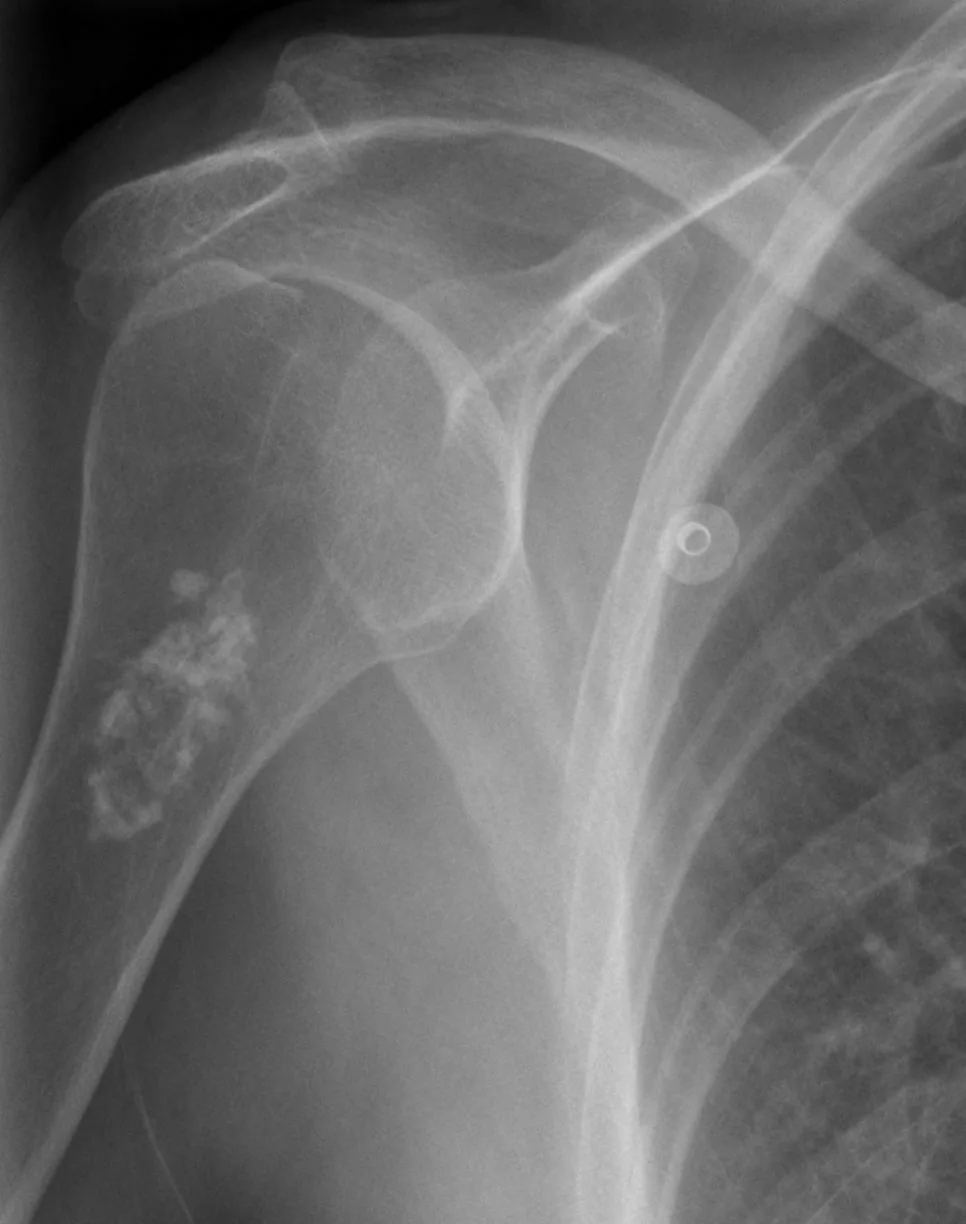 Bone & joint disease radiograph for self-assessment