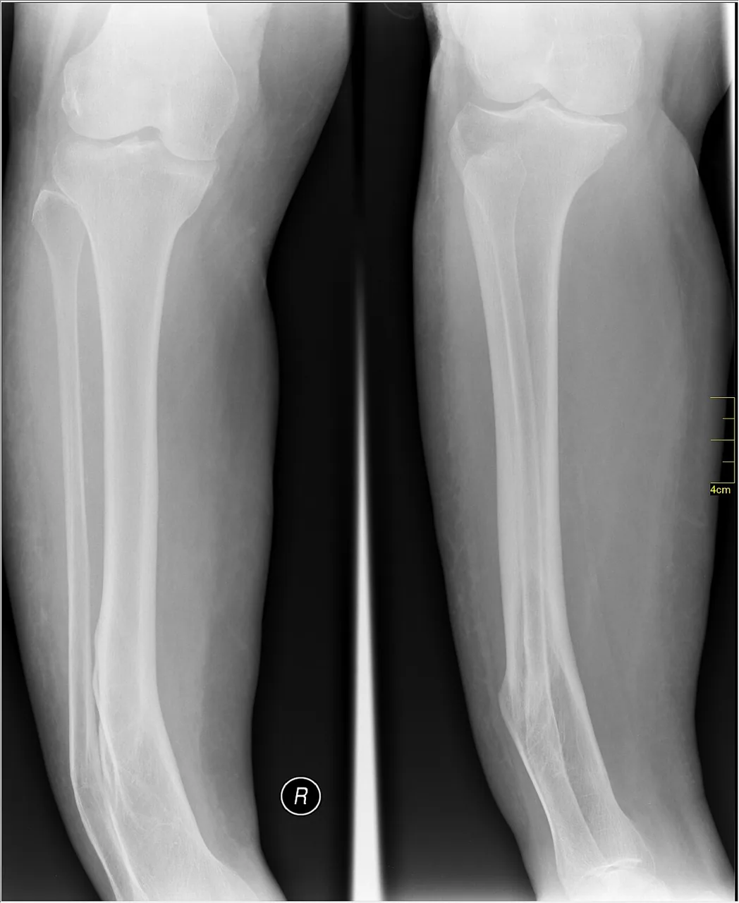 Lower limb radiograph for self-assessment