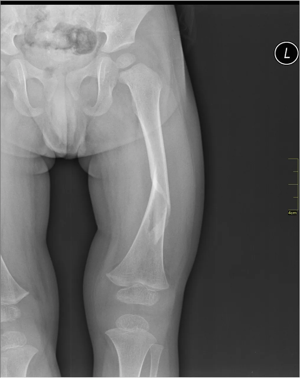 Lower limb radiograph for self-assessment