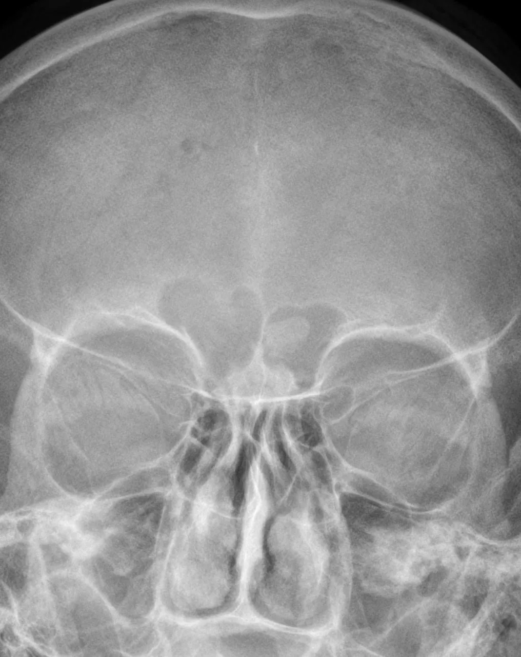 Bone & joint disease radiograph for self-assessment