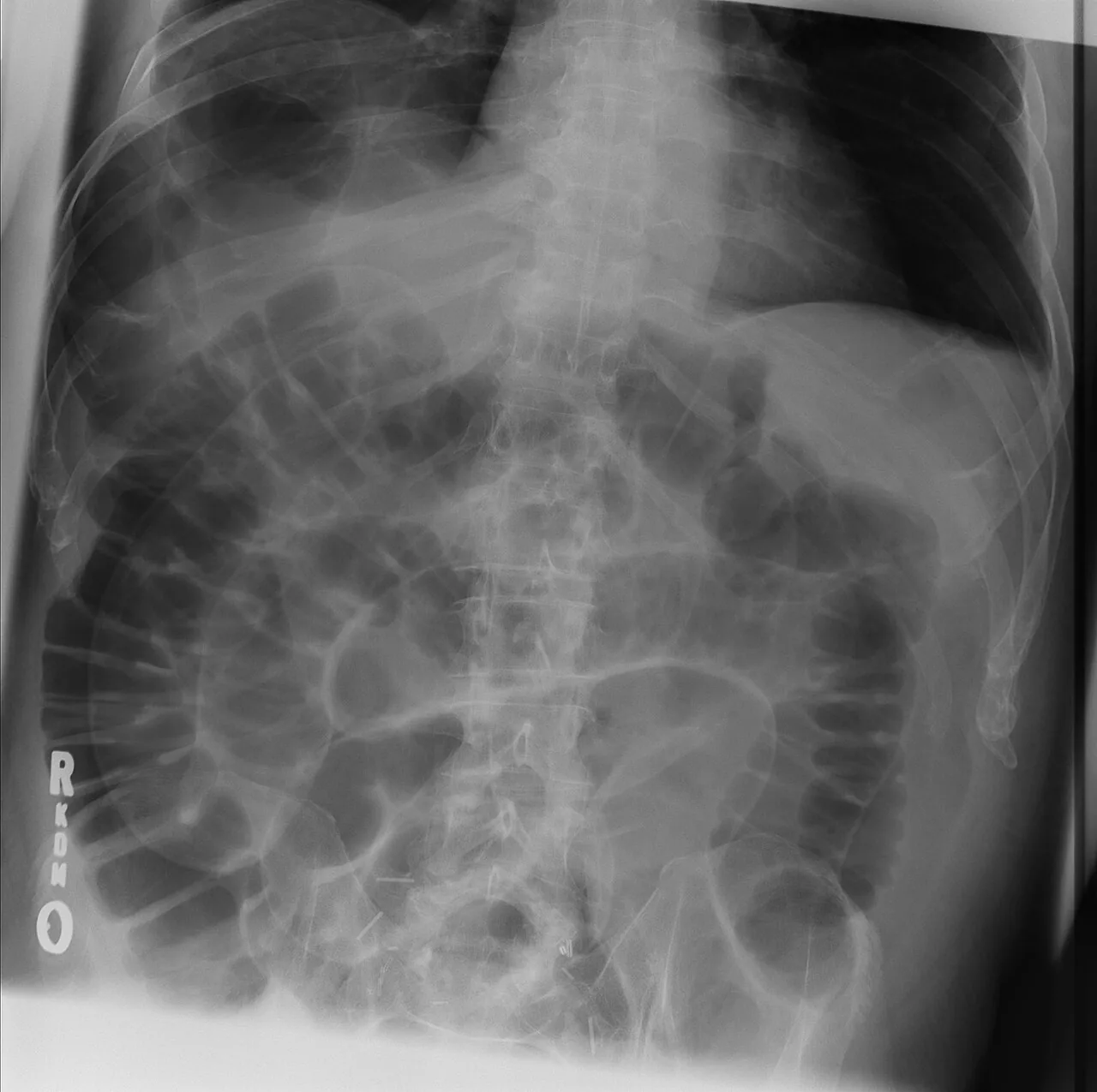 Abdomen radiograph for self-assessment