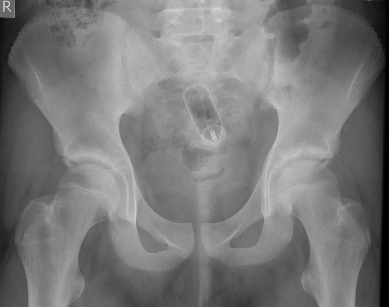 Abdomen radiograph for self-assessment
