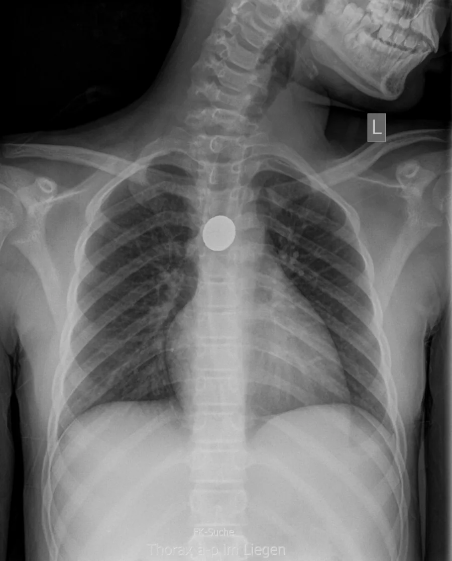Paediatric radiograph for self-assessment