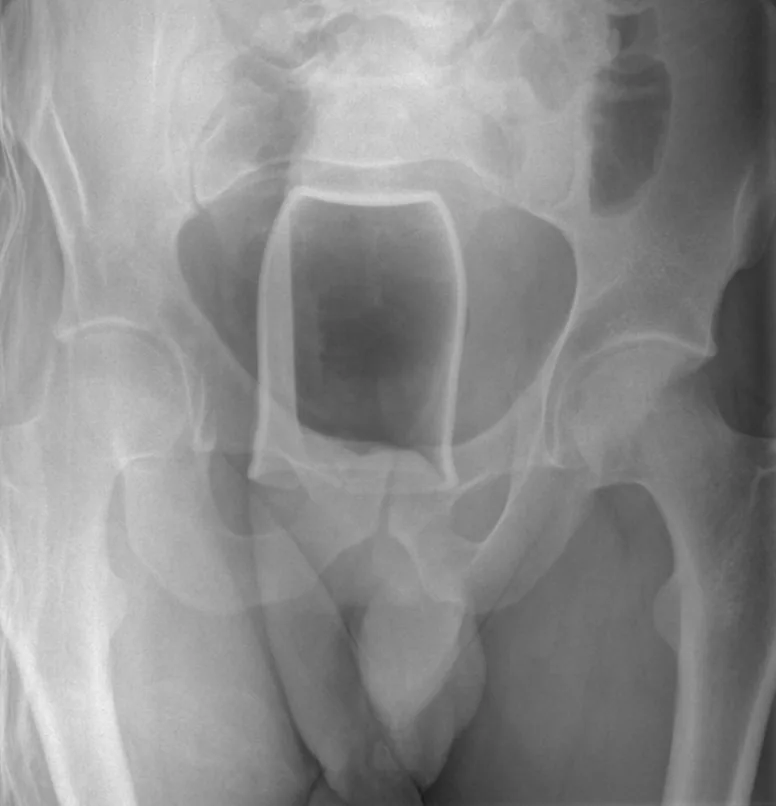Abdomen radiograph for self-assessment