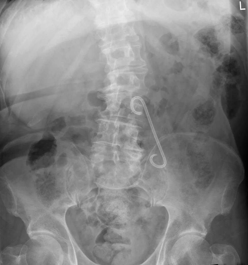 Abdomen radiograph for self-assessment
