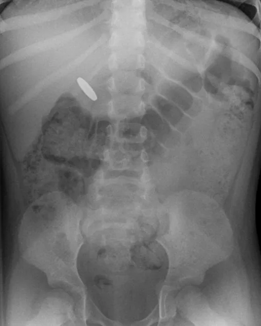 Abdomen radiograph for self-assessment
