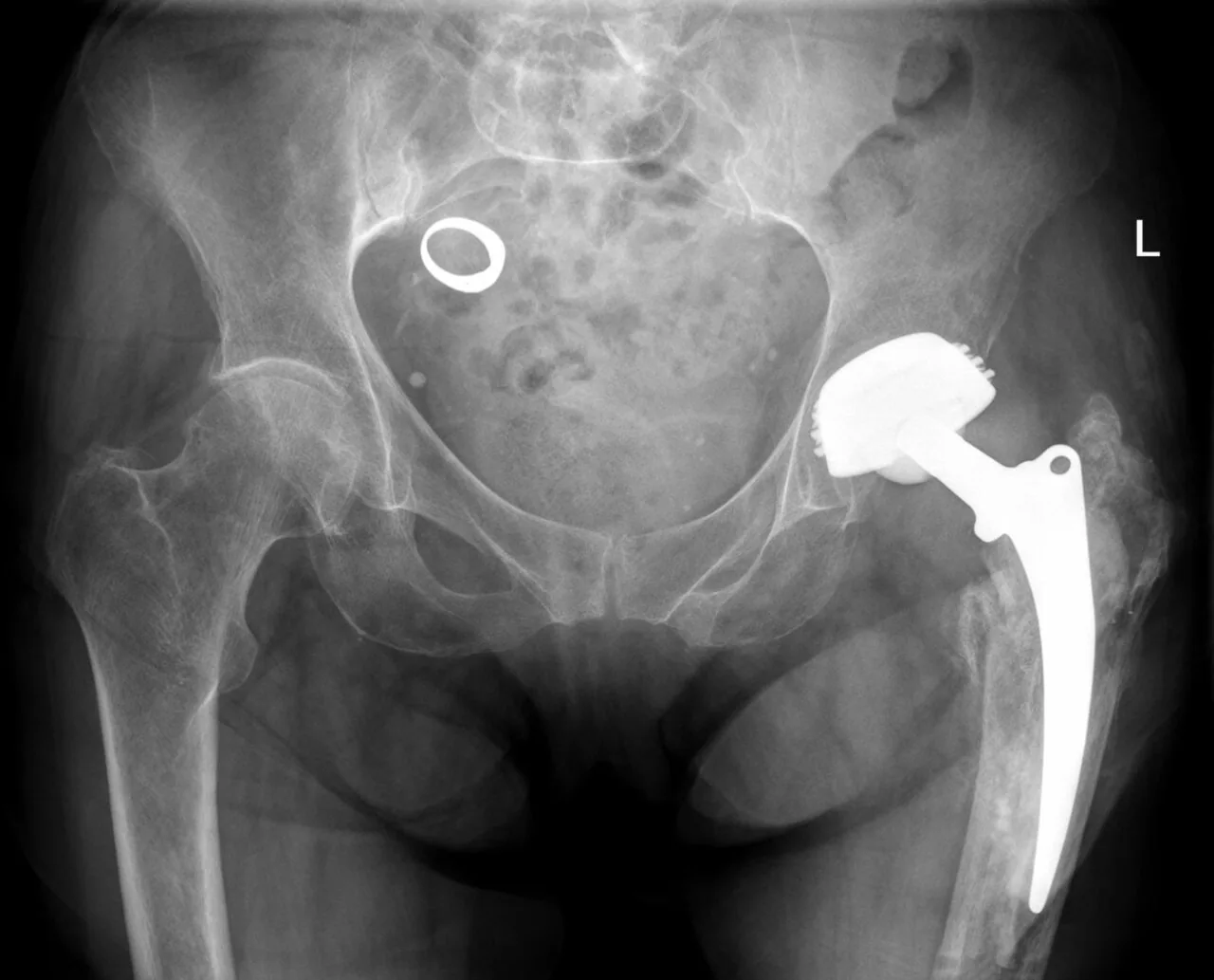 Abdomen radiograph for self-assessment