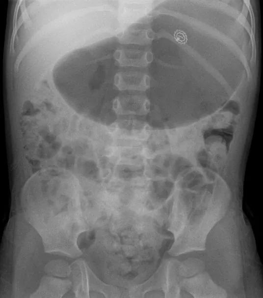 Abdomen radiograph for self-assessment