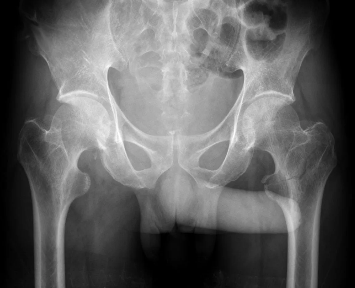 Lower limb radiograph for self-assessment
