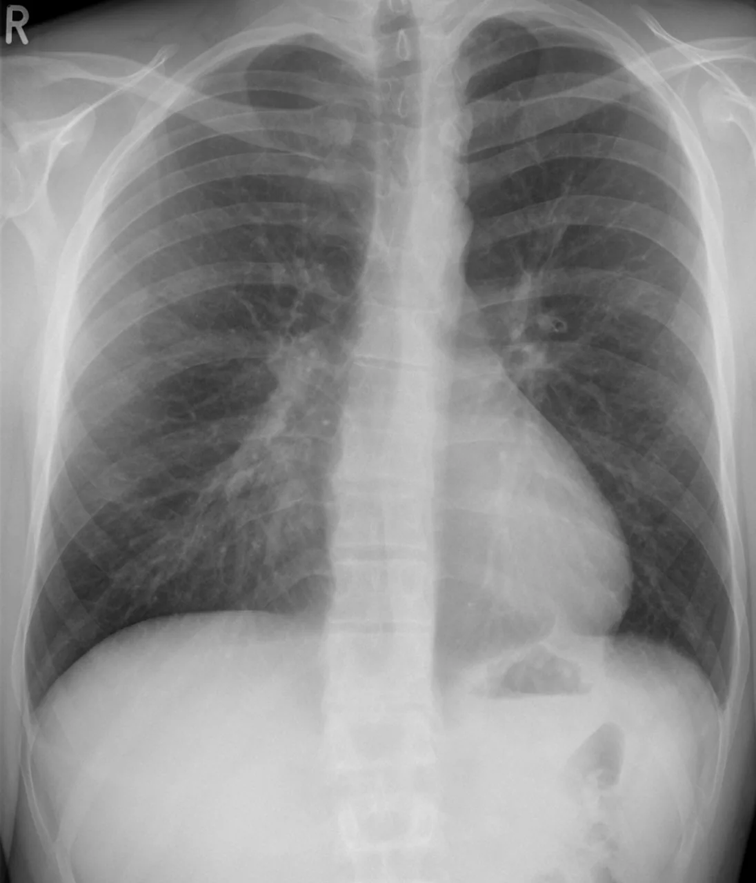 Chest radiograph for self-assessment
