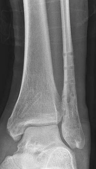 Lower limb radiograph for self-assessment