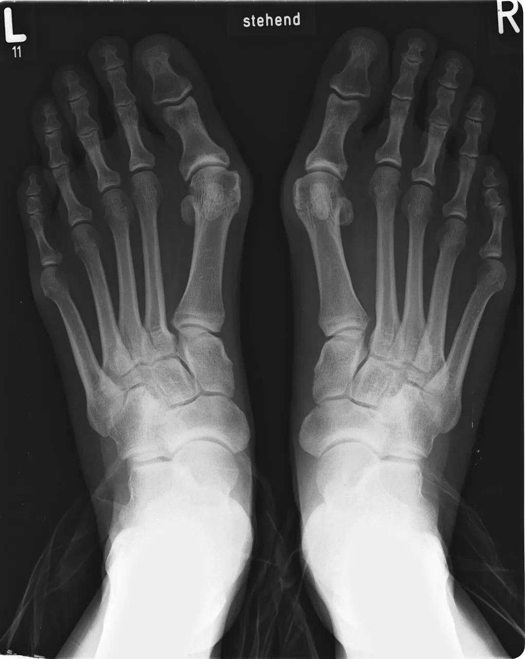 Bone & joint disease radiograph for self-assessment