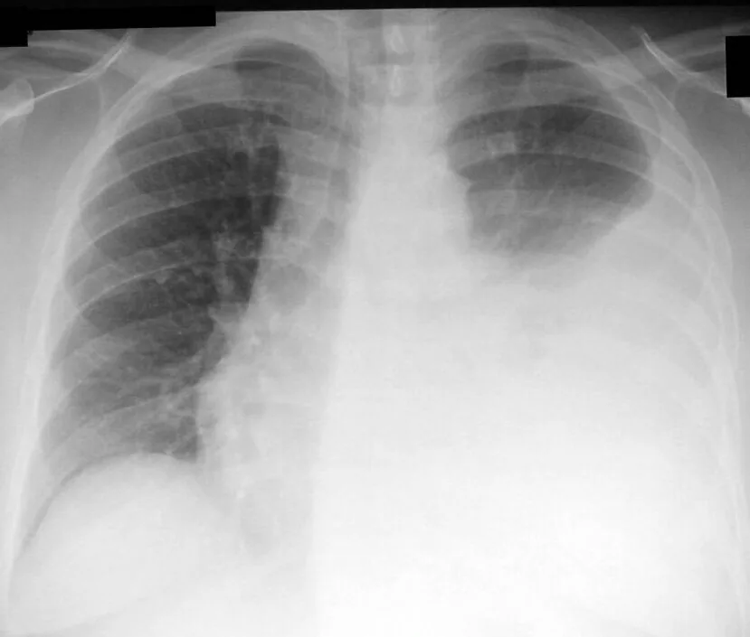 Chest radiograph for self-assessment