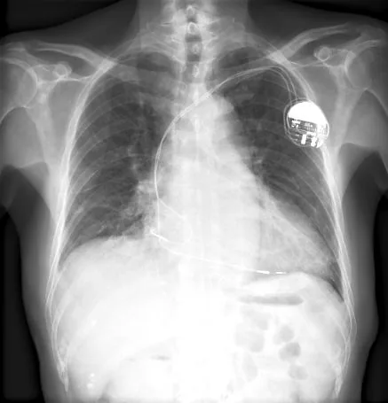Lines & tubes radiograph for self-assessment