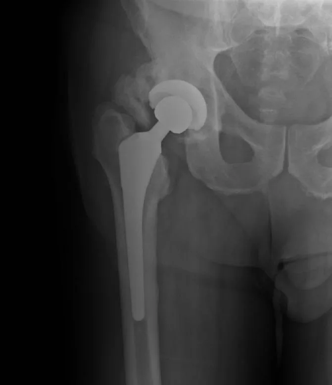 Bone & joint disease radiograph for self-assessment