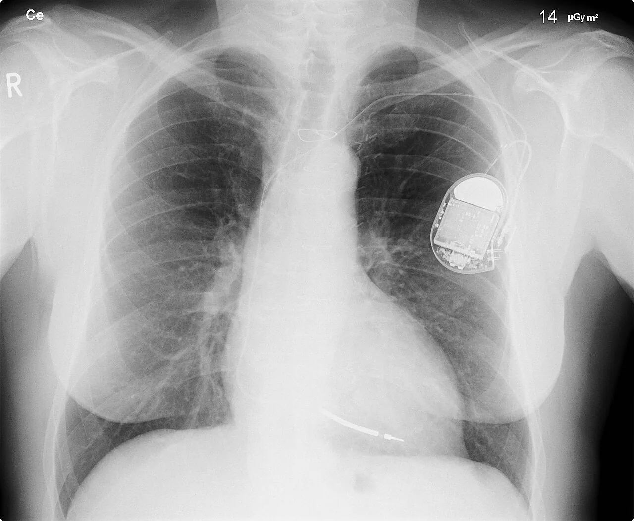 Lines & tubes radiograph for self-assessment