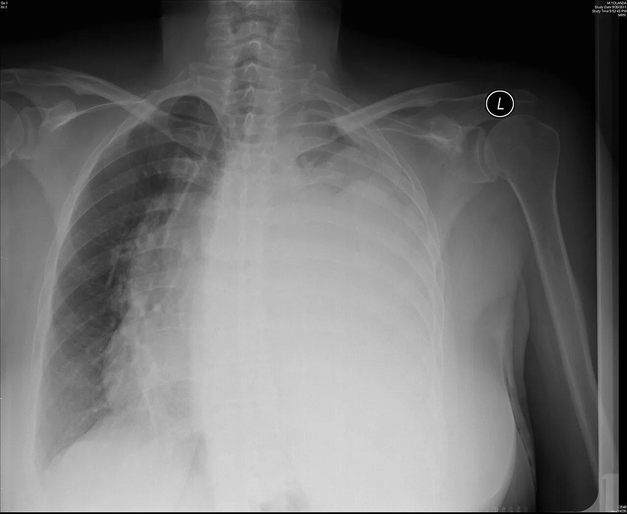 Chest radiograph for self-assessment