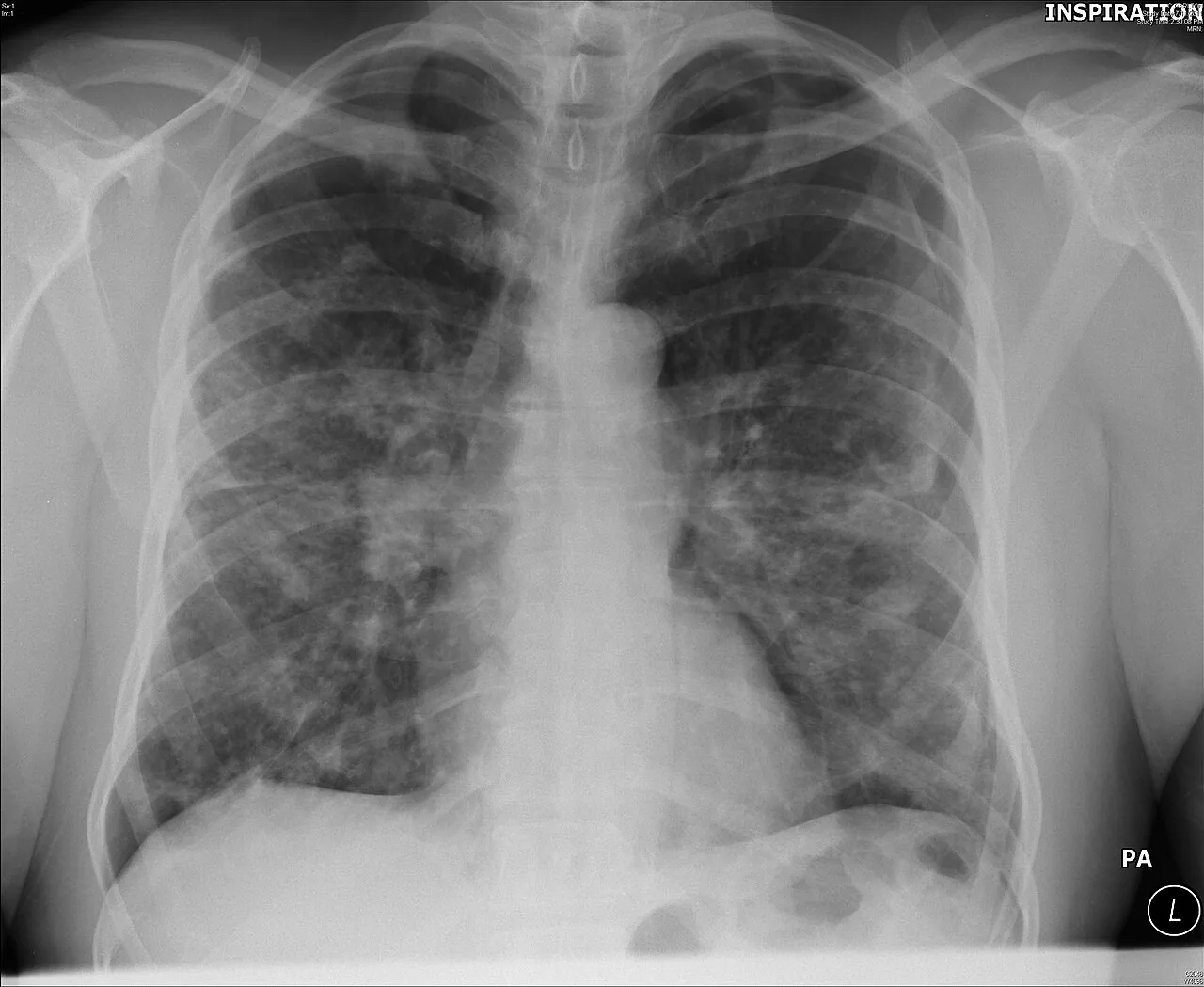 Chest radiograph for self-assessment
