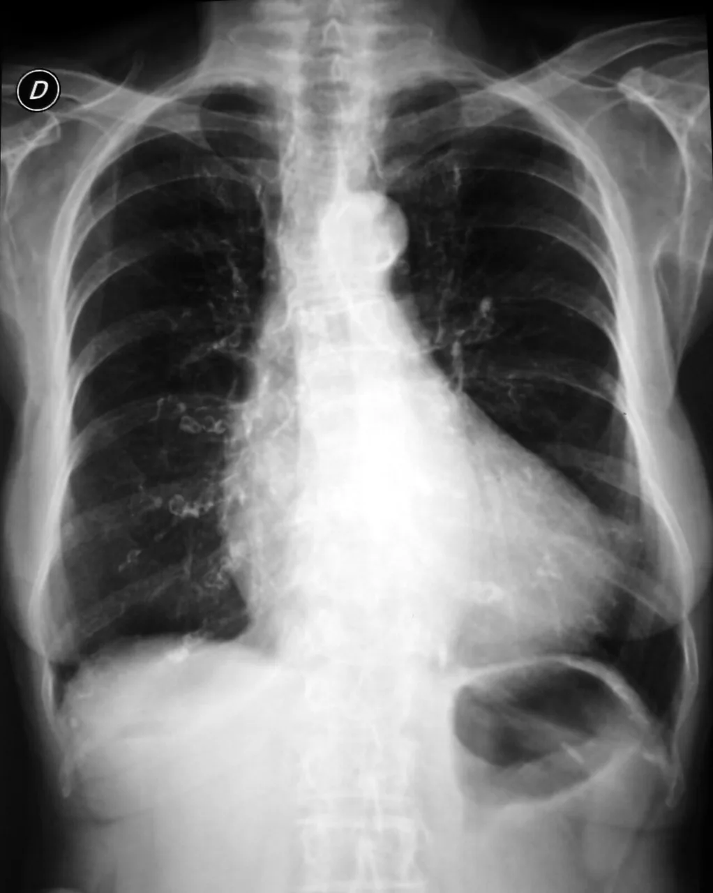 Chest radiograph for self-assessment