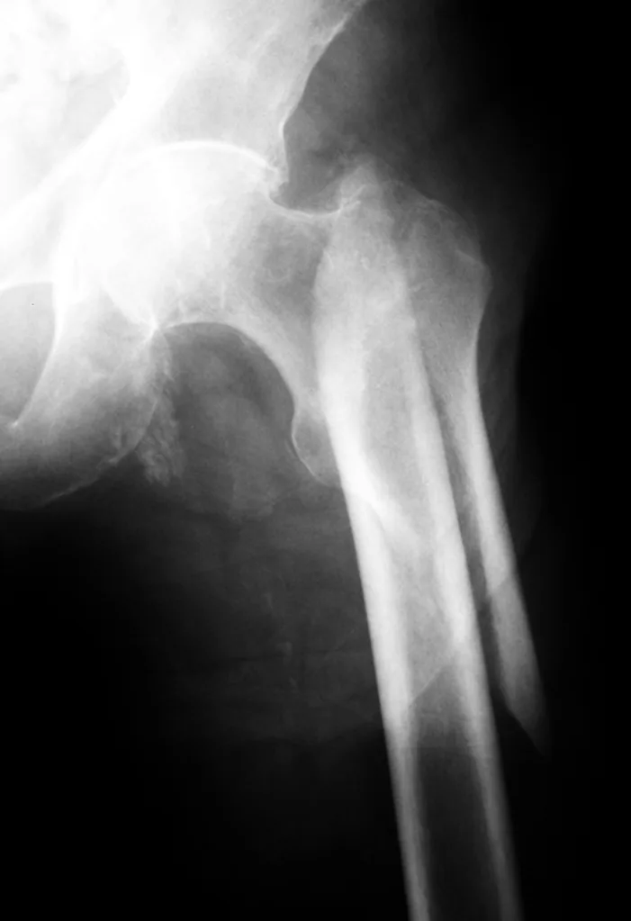 Lower limb radiograph for self-assessment