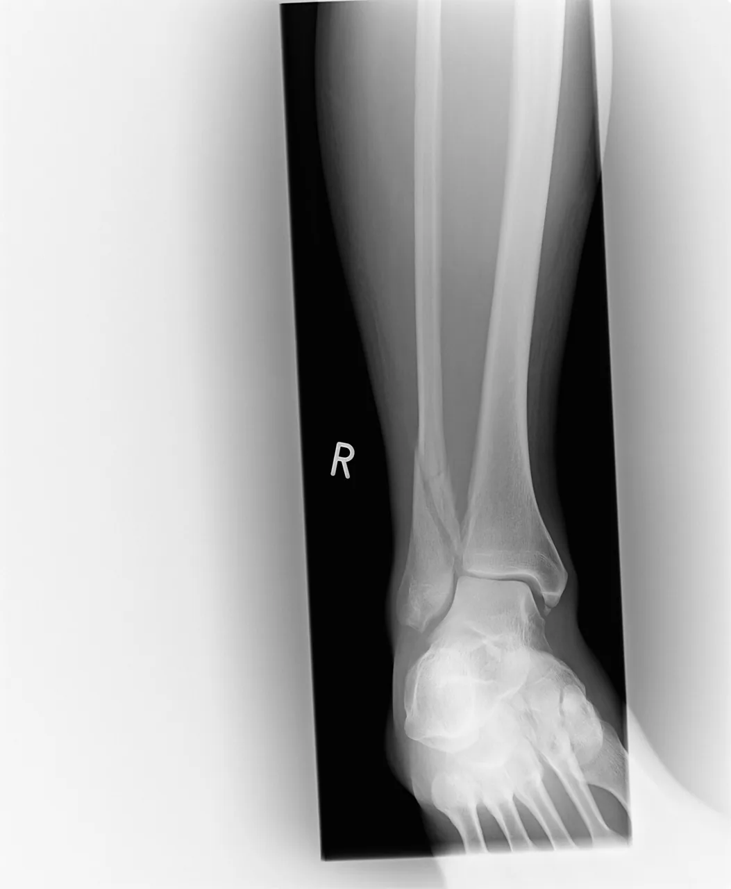 Lower limb radiograph for self-assessment
