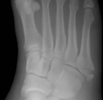 Lower limb radiograph for self-assessment