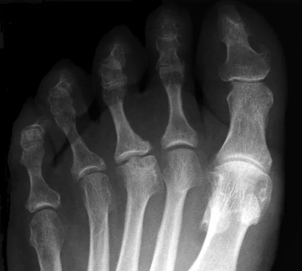 Bone & joint disease radiograph for self-assessment