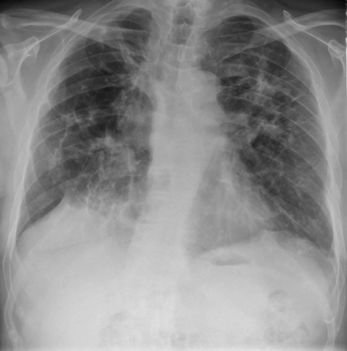 Chest radiograph for self-assessment
