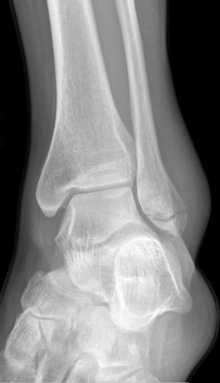 Lower limb radiograph for self-assessment