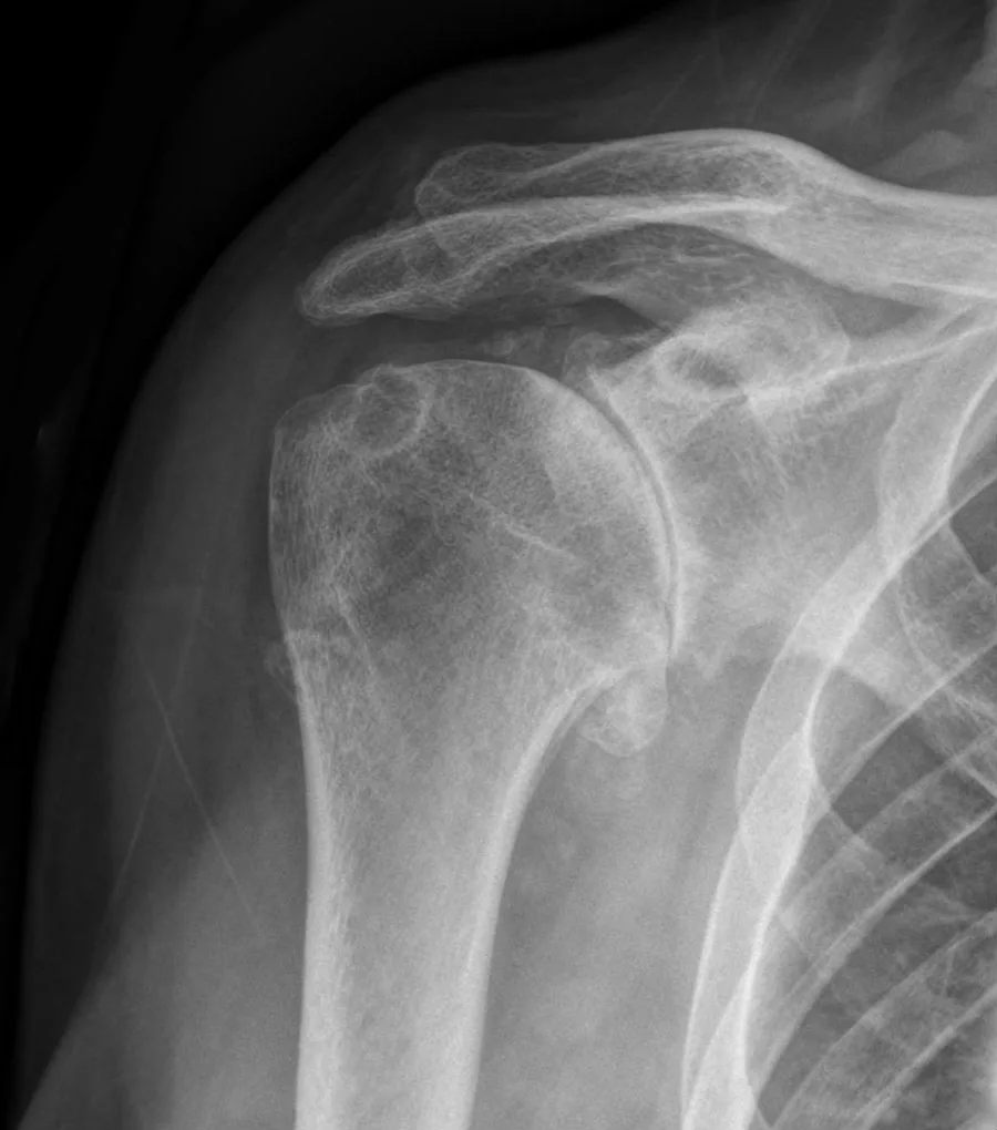 Bone & joint disease radiograph for self-assessment