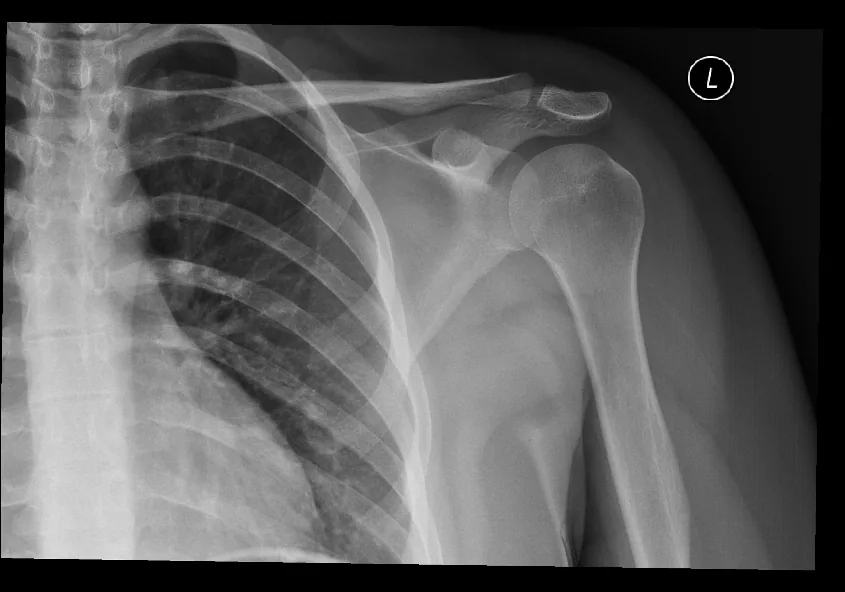 Upper limb radiograph for self-assessment