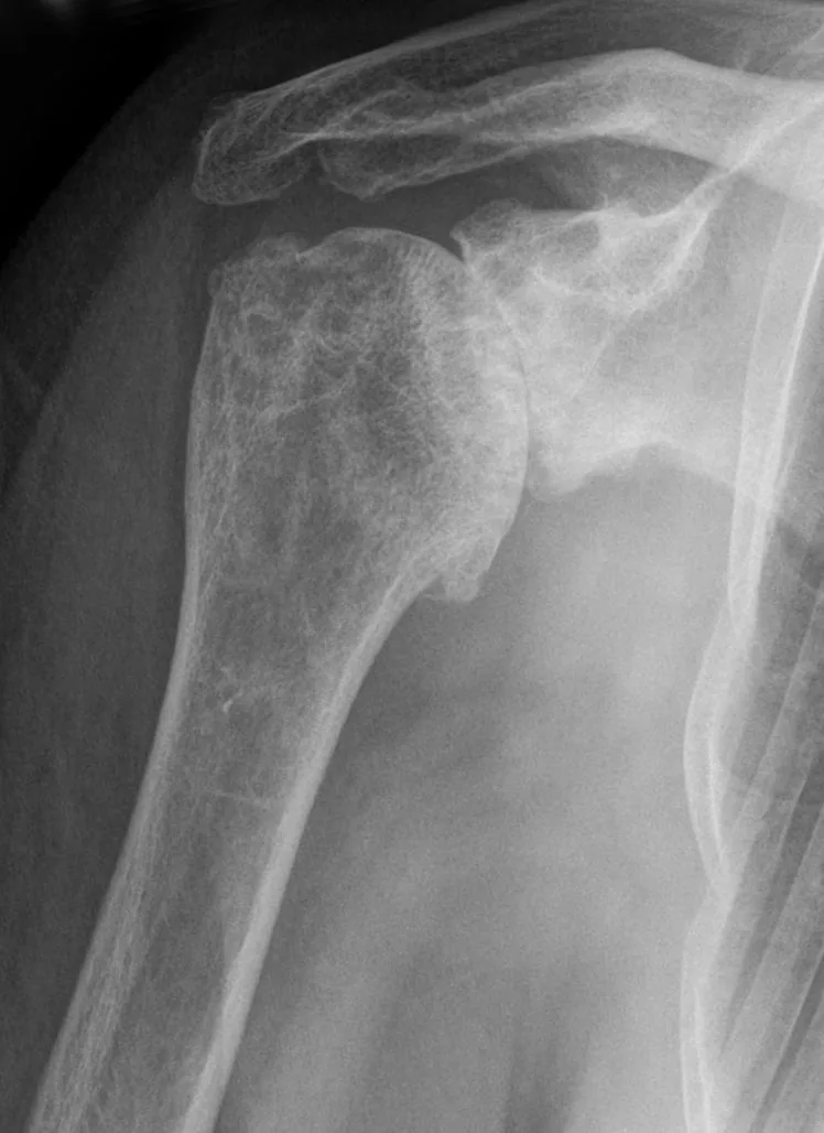 Bone & joint disease radiograph for self-assessment
