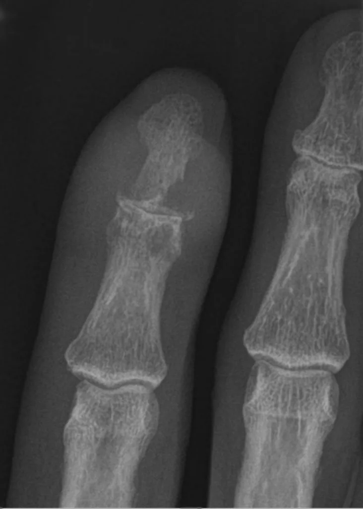 Bone & joint disease radiograph for self-assessment